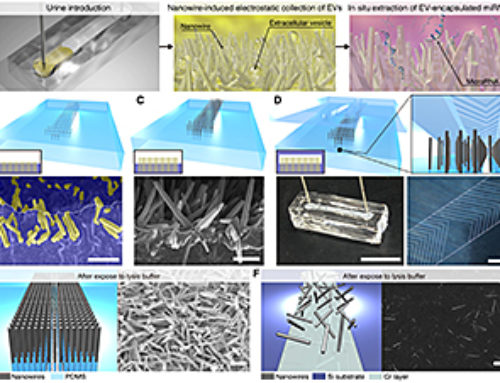 Nanowire device detects cancer with a urine test