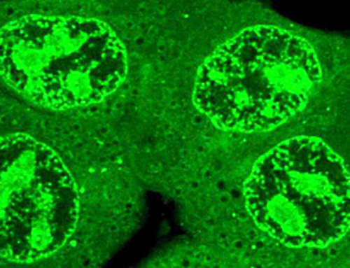Machine learning helps predict drugs’ favorite subcellular haunts