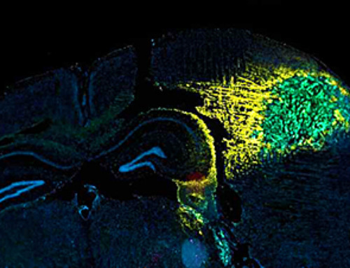 Treating tumors with engineered dendritic cells