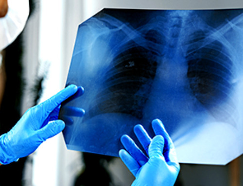 Scientists Just Overturned a 100-Year-Old Belief About Bacteria in the Lungs