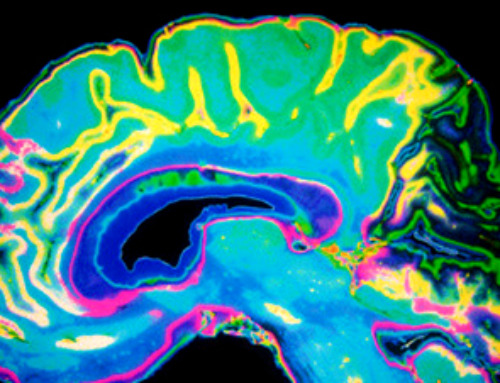 Researchers map brain networks involved in word retrieval