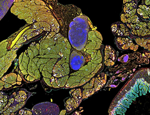 Scientists May Have Found a Secret Weapon To Stop Pancreatic Cancer Before It Starts