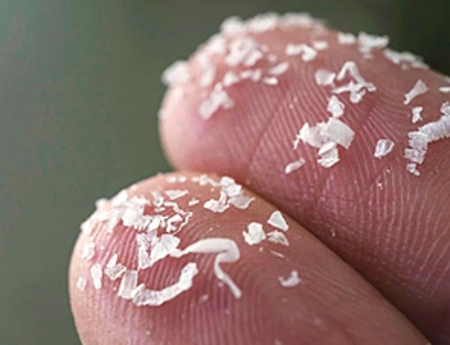 Microplastics Are Invading Our Arteries, and It Could Be Increasing Your Risk of Stroke
