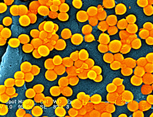 Superbug crisis could get worse, killing nearly 40 million people by 2050