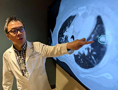 AI matches doctors in mapping lung tumors for radiation therapy