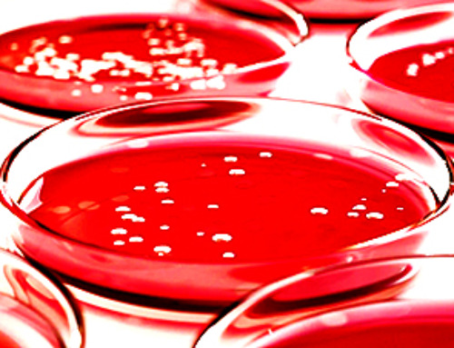 Generative AI Designs Novel Antibiotics That Defeat Defiant Drug-Resistant Superbugs