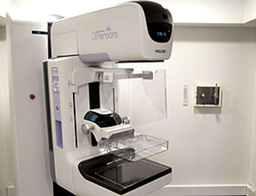 AI finds more breast tumors earlier than traditional double radiologist review