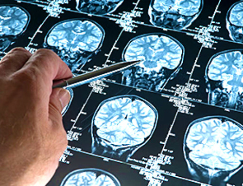 Your brain could get bigger – not smaller – as you age