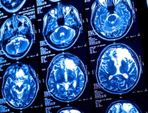 New Research Reveals Nanoplastics’ Damaging Effect on Brain Cells