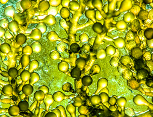 Review: How Could Microalgal Nanoparticles Treat Cancer?