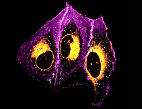 Quantitative imaging method reveals how cells rapidly sort and transport lipids