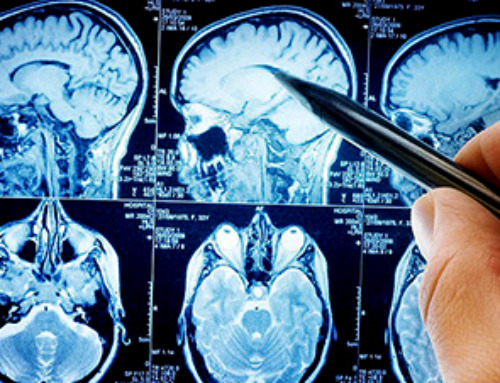 Scientists make huge Parkinson’s breakthrough as they discover ‘protein trigger’