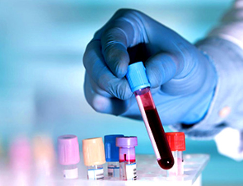 Breakthrough Blood Test Detects Head and Neck Cancer up to 10 Years Before Symptoms