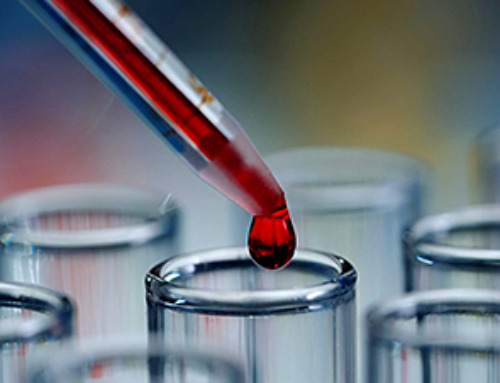It’s Not “All in Your Head”: Scientists Develop Revolutionary Blood Test for Chronic Fatigue Syndrome