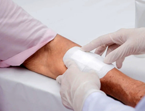 Nanotech Blocks Infection and Speed Up Chronic Wound Recovery