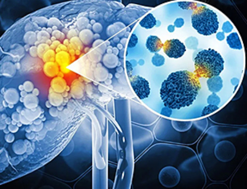 Ultrasound-activated Nanoparticles Kill Liver Cancer and Activate Immune System