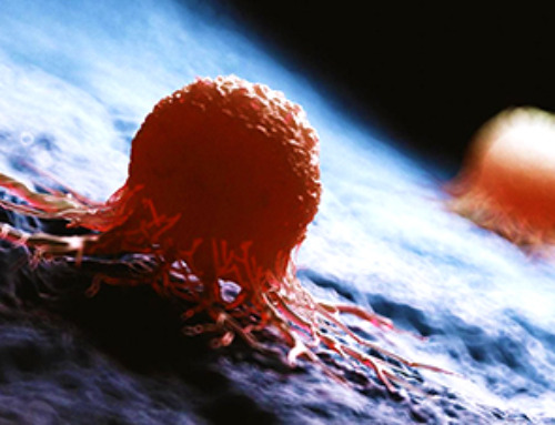 Concerning New Research Reveals Colon Cancer Is Skyrocketing in Adults Under 50