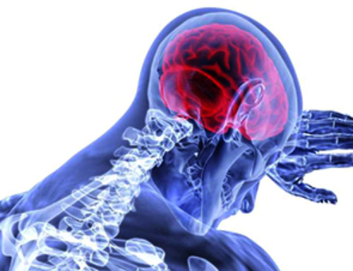 Very low LDL-cholesterol correlates to fewer heart problems after stroke