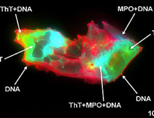 Scientists Uncover Hidden Blood Pattern in Long COVID