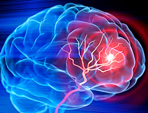 Scientists Develop IV Therapy That Repairs the Brain After Stroke