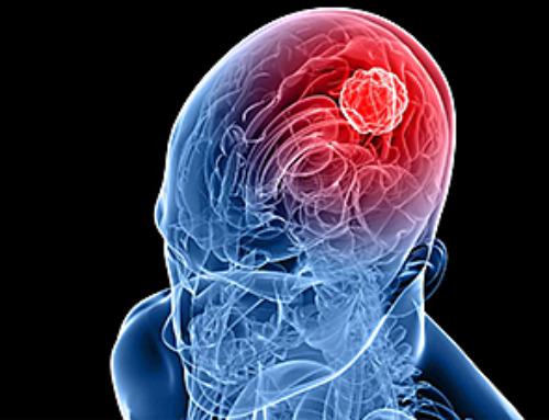 New Molecule Blocks Deadliest Brain Cancer at Its Genetic Root