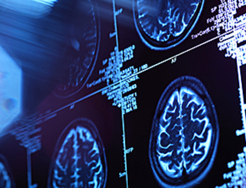 New “Cellular” Target Could Transform How We Treat Alzheimer’s Disease