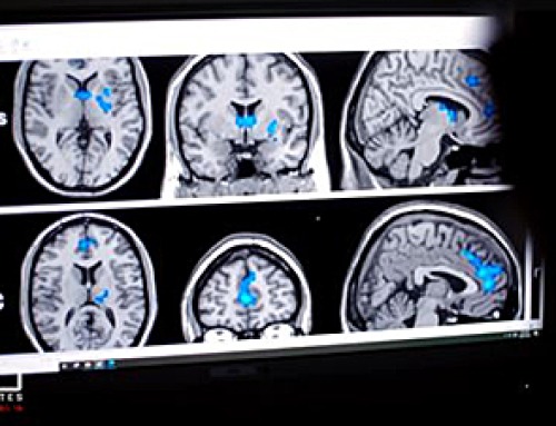 Digital Dementia – Brain fog and disassociation from being chronically online