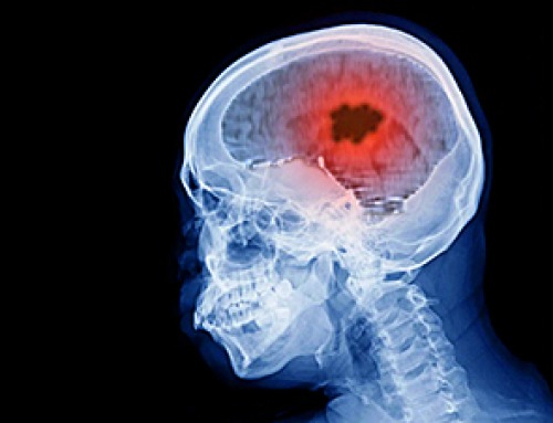 New Vitamin B12-Based Therapy Could Change How Brain Cancer Is Treated