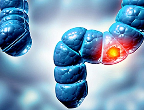 Why More People in Their 30s Are Suddenly Getting Colon Cancer