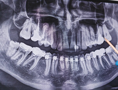 Scientists Discover Stem Cells That Could Regrow Teeth and Bone