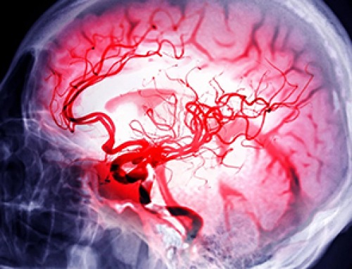 Scientists Discover Surprising Way To Help the Brain Recover After Stroke