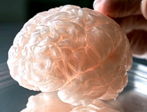 3D Human Brain Tissue Model Replicates Alzheimer’s Pathology