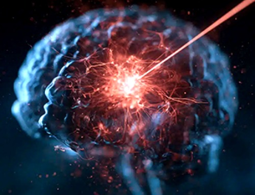 Focused Ultrasound Opens Blood-Brain Barrier to Treat Brain Cancer