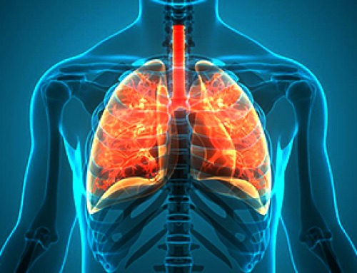 Engineered tRNAs and lipid nanoparticles target nonsense mutation cystic fibrosis