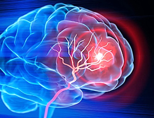 New injectable treatment helps the brain rebuild after stroke