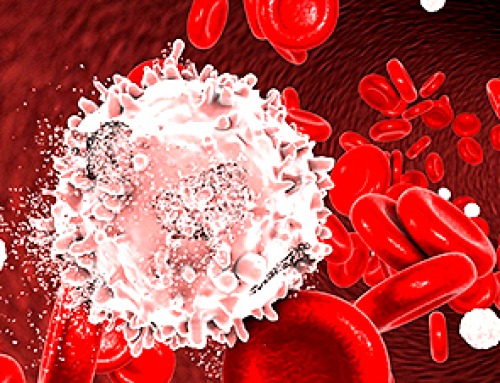 Your Bones May Hold a Hidden Clue to Blood Cancer Survival