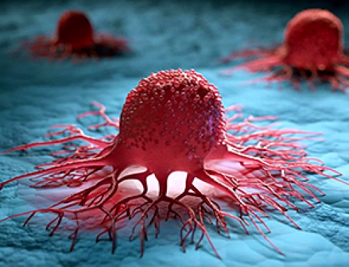 Inflammation May Awaken Dormant Cancer Cells Years After Treatment