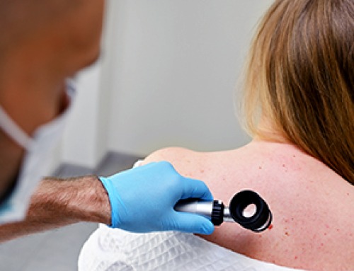 Melanoma mRNA Vaccine Shows Promise in Preventing Disease Recurrence